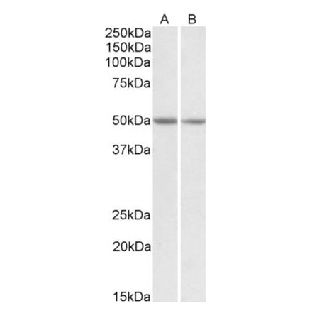 Western Blot - Anti-GNAS Antibody (A83016) - Antibodies.com