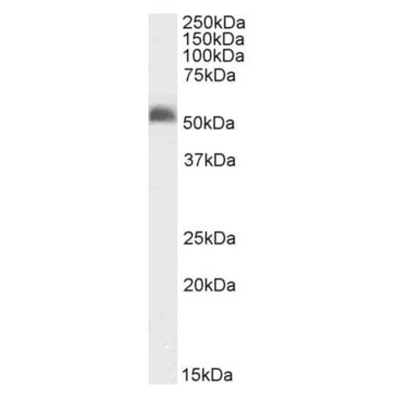 Western Blot - Anti-GABRG2 Antibody (A83017) - Antibodies.com