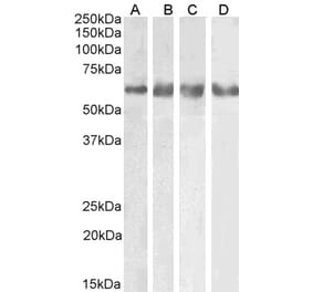 Western Blot - Anti-GABRG2 Antibody (A83018) - Antibodies.com