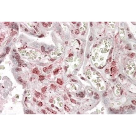 Immunohistochemistry - Anti-MLX Antibody (A83019) - Antibodies.com