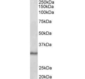 Western Blot - Anti-CTDSP1 Antibody (A83021) - Antibodies.com