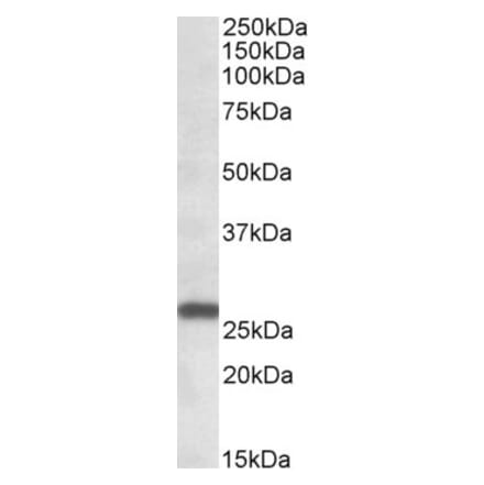 Western Blot - Anti-PREI3 Antibody (A83023) - Antibodies.com