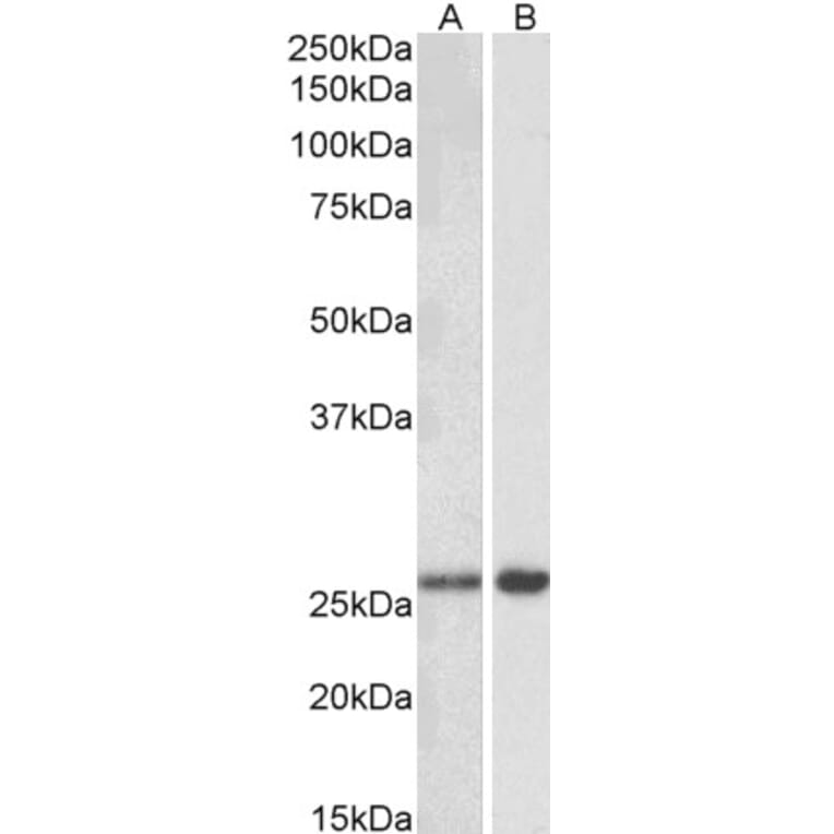 Western Blot - Anti-PREI3 Antibody (A83023) - Antibodies.com