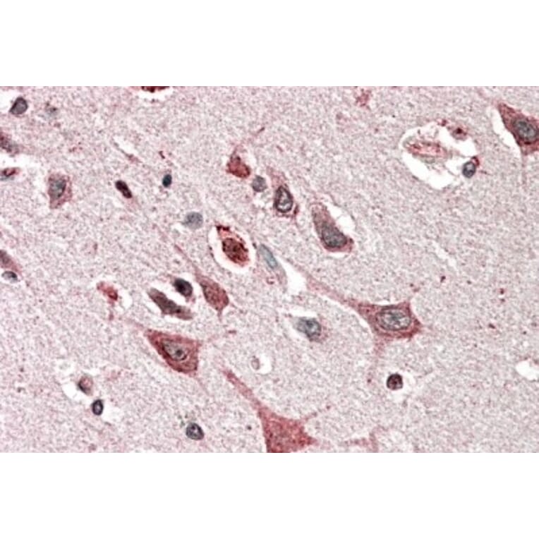 Immunohistochemistry - Anti-PREI3 Antibody (A83023) - Antibodies.com