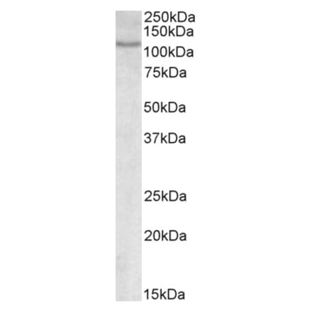 Western Blot - Anti-NFATC2 Antibody (A83024) - Antibodies.com