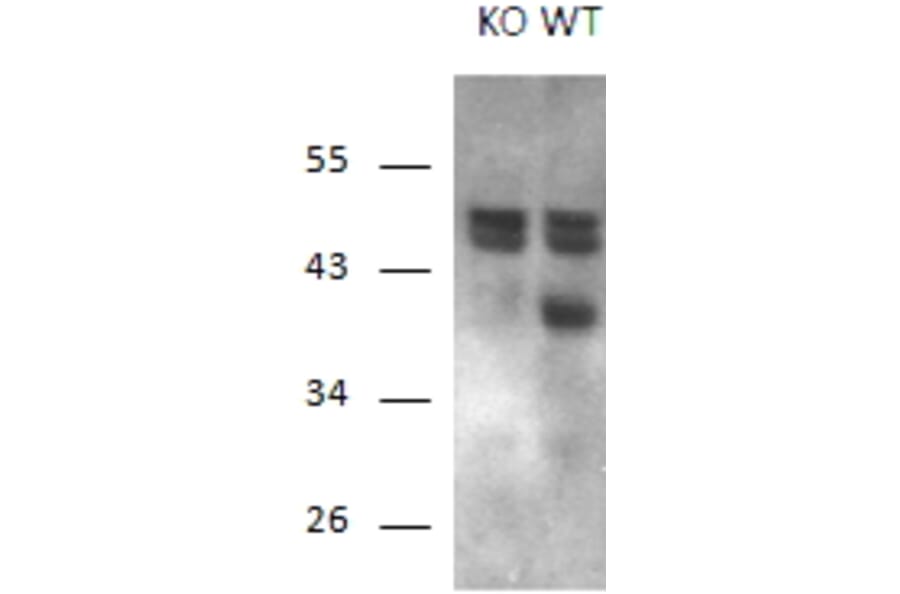 Western Blot - Anti-Calcipressin 1/RCAN1 Antibody (A83025) - Antibodies.com