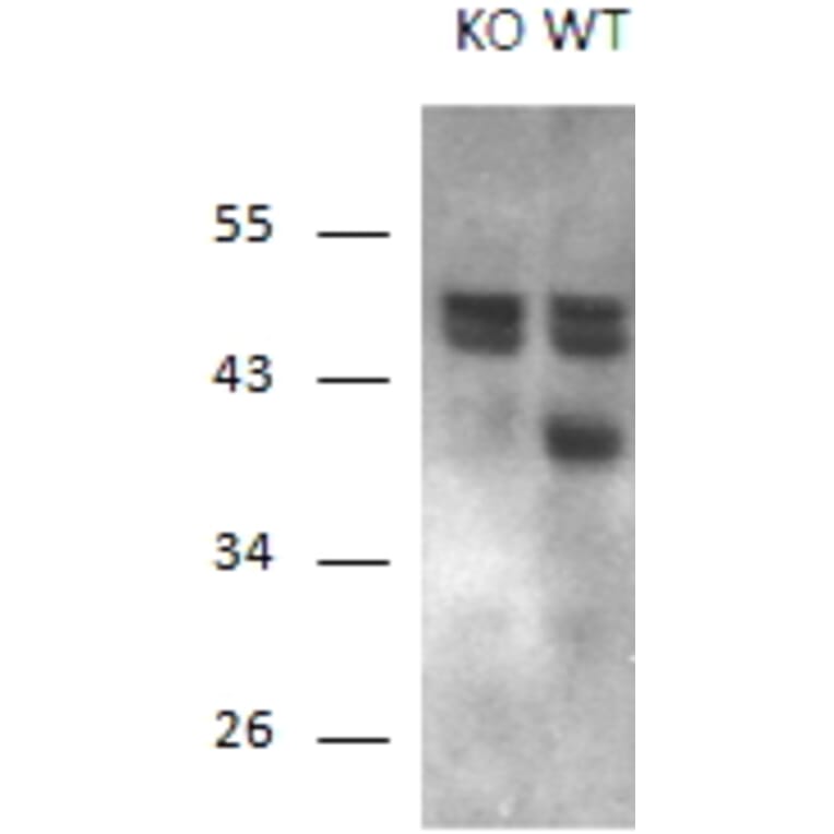 Western Blot - Anti-Calcipressin 1/RCAN1 Antibody (A83025) - Antibodies.com