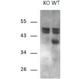 Western Blot - Anti-Calcipressin 1/RCAN1 Antibody (A83025) - Antibodies.com