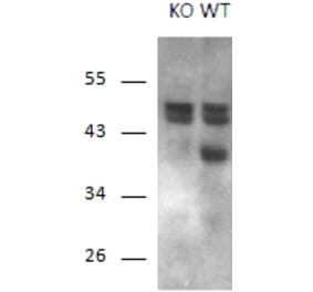 Western Blot - Anti-RCAN1 Antibody (A83025) - Antibodies.com