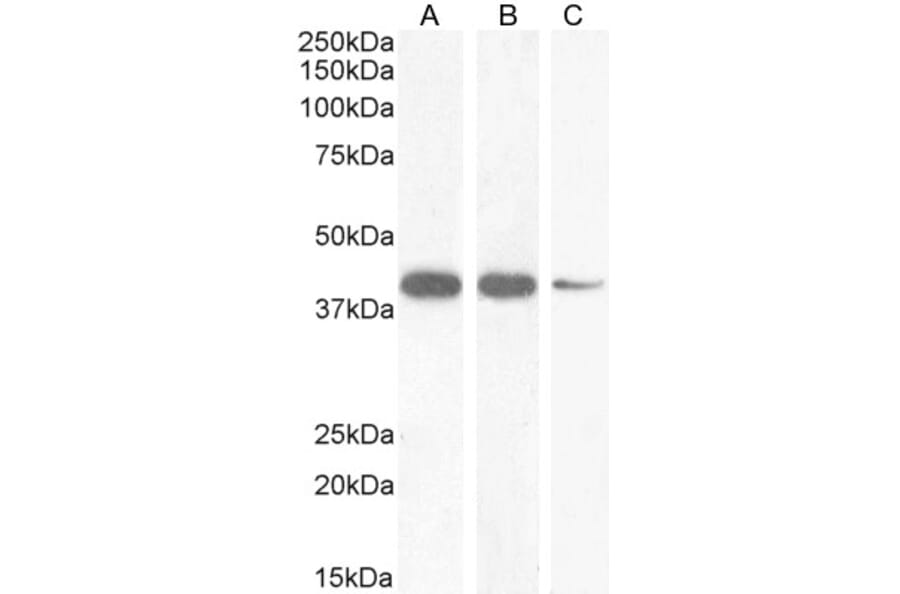 Western Blot - Anti-Nkx2.5 Antibody (A83026) - Antibodies.com