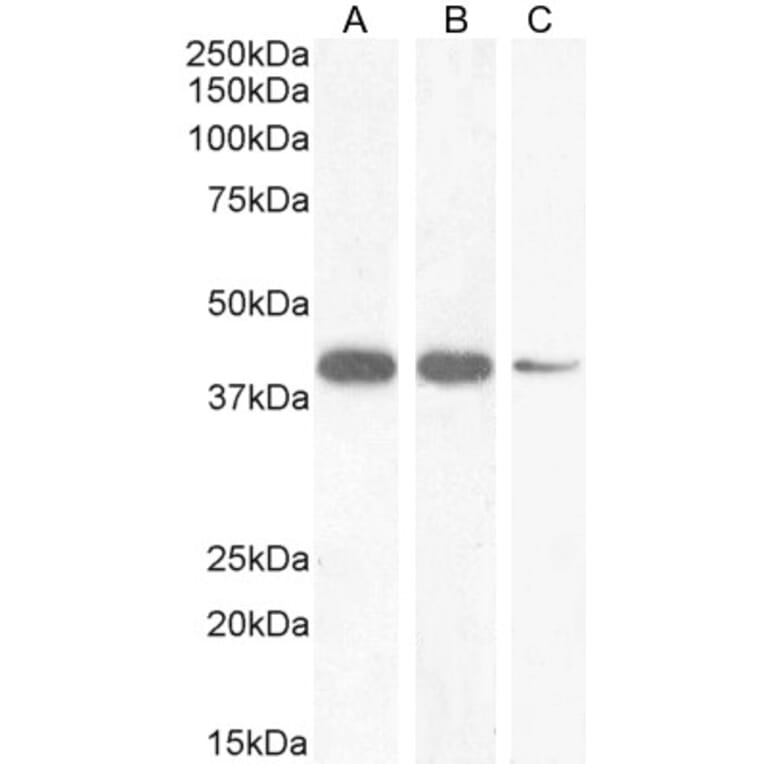 Western Blot - Anti-Nkx2.5 Antibody (A83026) - Antibodies.com