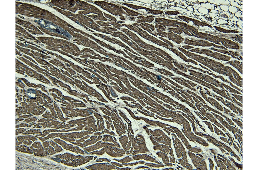 Immunohistochemistry - Anti-Nkx2.5 Antibody (A83026) - Antibodies.com