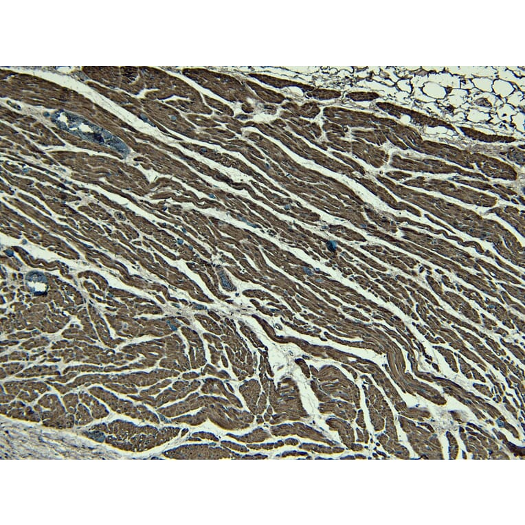 Immunohistochemistry - Anti-Nkx2.5 Antibody (A83026) - Antibodies.com