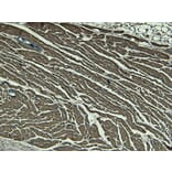 Immunohistochemistry - Anti-Nkx2.5 Antibody (A83026) - Antibodies.com