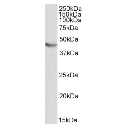 Western Blot - Anti-NKX2-5 Antibody (A83026)