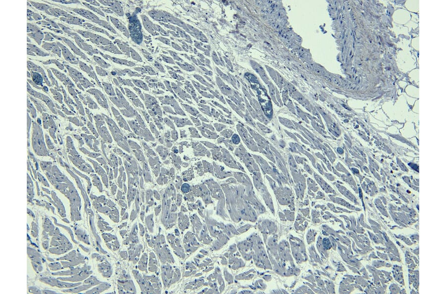 Immunohistochemistry - Anti-Nkx2.5 Antibody (A83026) - Antibodies.com