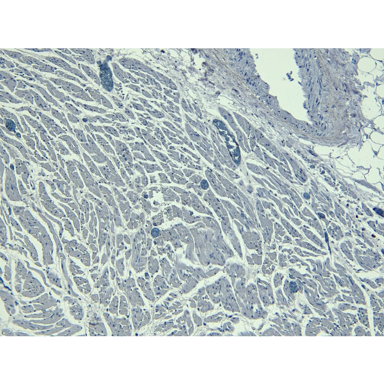 Immunohistochemistry - Anti-Nkx2.5 Antibody (A83026) - Antibodies.com
