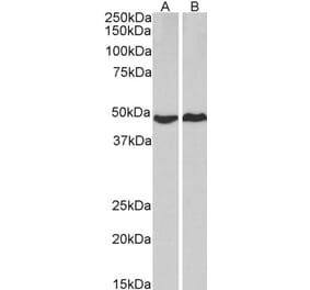 Western Blot - Anti-cAMP Protein Kinase Catalytic Subunit Antibody (A83028) - Antibodies.com