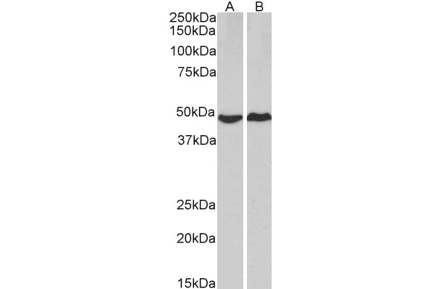 Western Blot - Anti-cAMP Protein Kinase Catalytic Subunit Antibody (A83028) - Antibodies.com