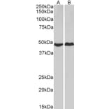 Western Blot - Anti-cAMP Protein Kinase Catalytic Subunit Antibody (A83028) - Antibodies.com