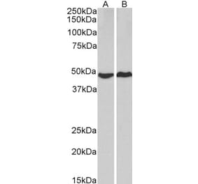 Western Blot - Anti-PRKACA Antibody (A83028) - Antibodies.com