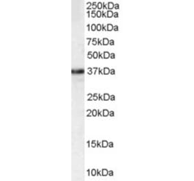 Western Blot - Anti-MPG Antibody (A83030) - Antibodies.com