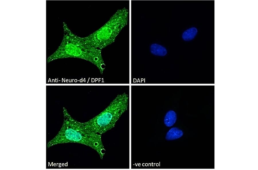 Immunofluorescence - Anti-Neuro D4 Antibody (A83032) - Antibodies.com