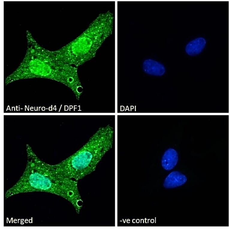 Immunofluorescence - Anti-Neuro D4 Antibody (A83032) - Antibodies.com