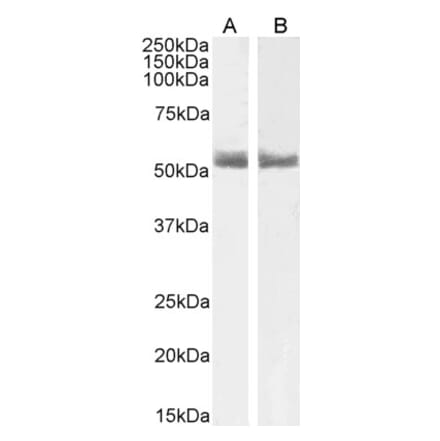 Western Blot - Anti-Retinoic Acid Receptor alpha Antibody (A83034) - Antibodies.com