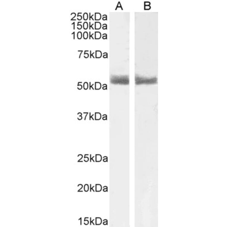 Western Blot - Anti-Retinoic Acid Receptor alpha Antibody (A83034) - Antibodies.com
