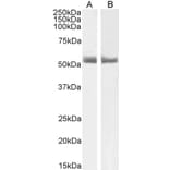 Western Blot - Anti-Retinoic Acid Receptor alpha Antibody (A83034) - Antibodies.com
