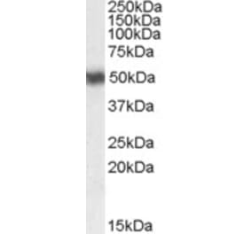 Western Blot - Anti-RARA Antibody (A83034) - Antibodies.com