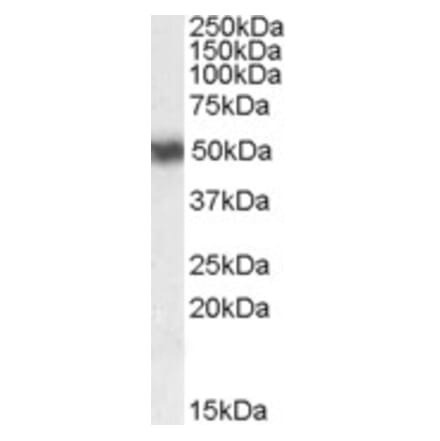 Western Blot - Anti-RARA Antibody (A83034) - Antibodies.com