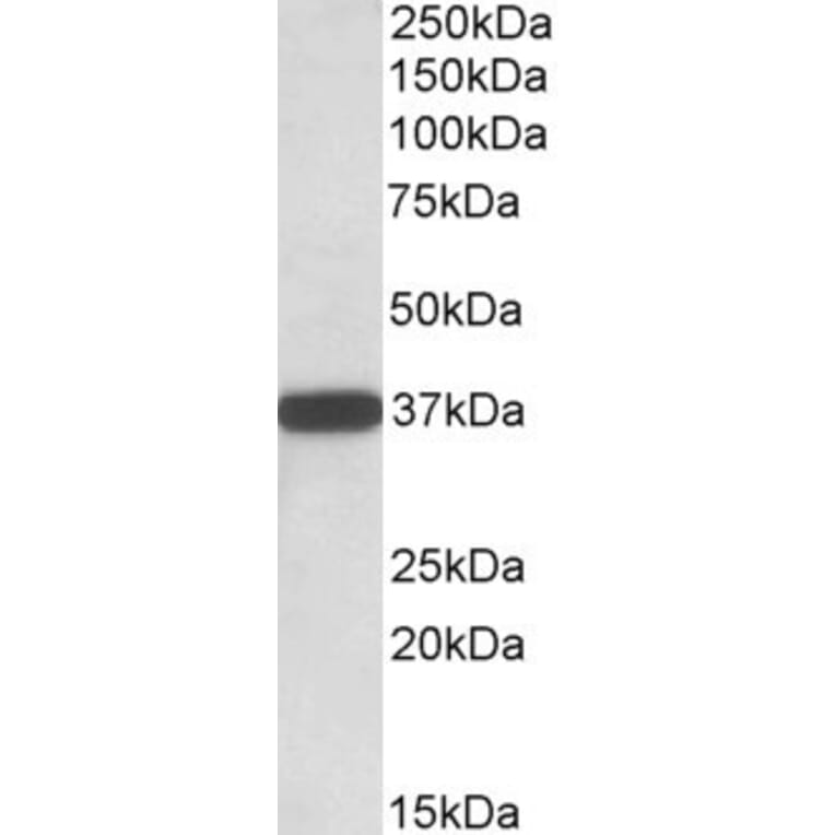 Western Blot - Anti-CYB5R3 Antibody (A83035) - Antibodies.com