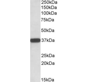 Western Blot - Anti-CYB5R3 Antibody (A83035) - Antibodies.com