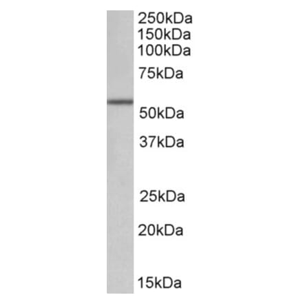 Western Blot - Anti-ALDH6A1 Antibody (A83037) - Antibodies.com