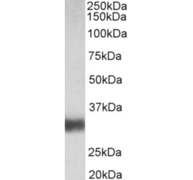 Western Blot - Anti-SFTPA1 Antibody (A83038) - Antibodies.com