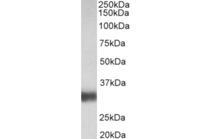 Western Blot - Anti-SFTPA1 Antibody (A83038) - Antibodies.com