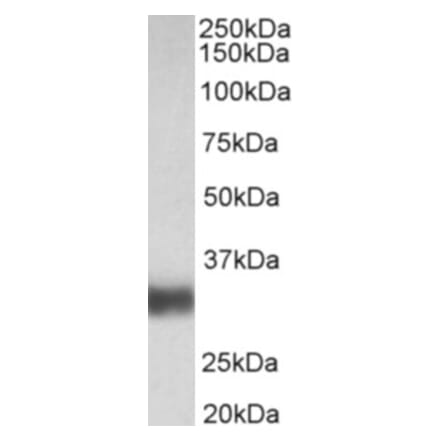 Western Blot - Anti-SFTPA1 Antibody (A83038) - Antibodies.com