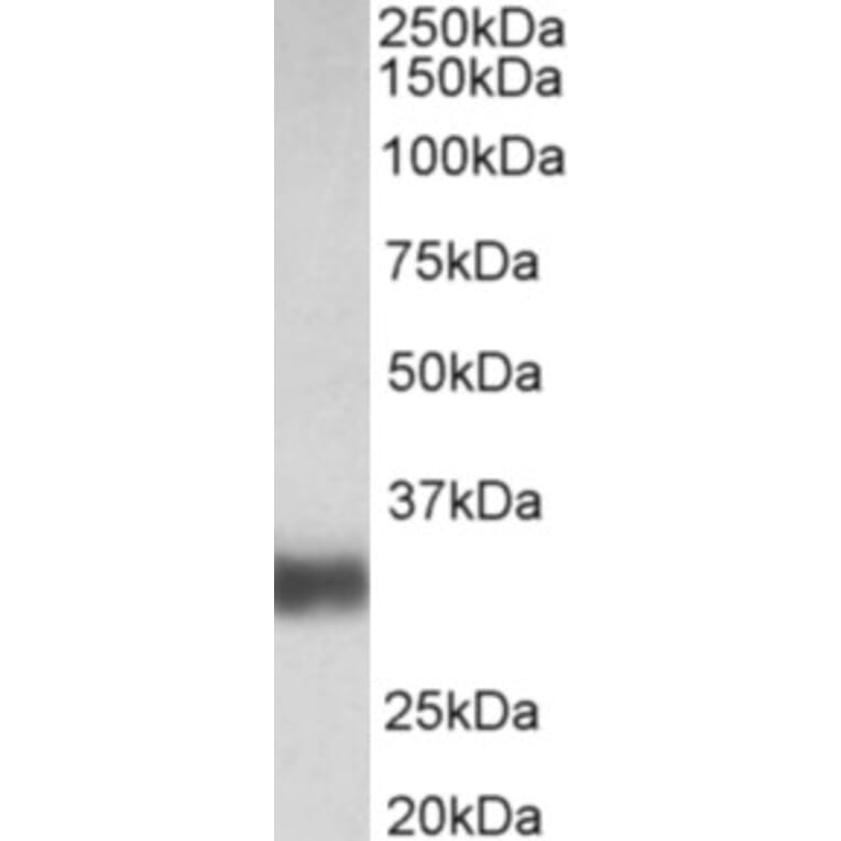 Western Blot - Anti-SFTPA1 Antibody (A83038) - Antibodies.com