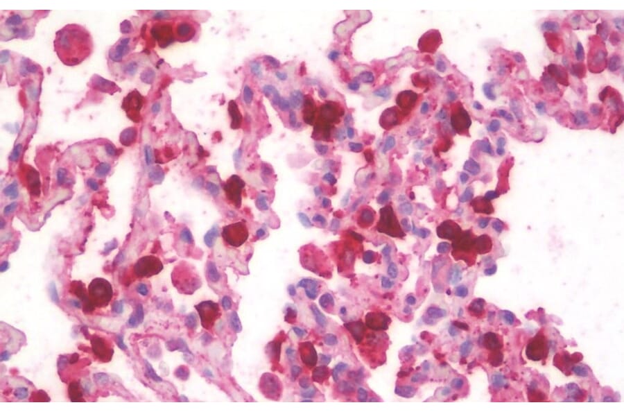 Immunohistochemistry - Anti-SFTPA1 Antibody (A83038) - Antibodies.com