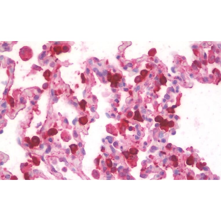 Immunohistochemistry - Anti-SFTPA1 Antibody (A83038) - Antibodies.com