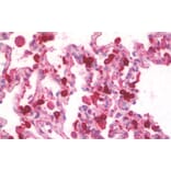 Immunohistochemistry - Anti-SFTPA1 Antibody (A83038) - Antibodies.com