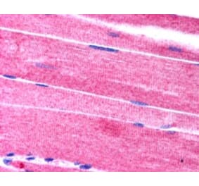 Immunohistochemistry - Anti-SORBS1 Antibody (A83040) - Antibodies.com