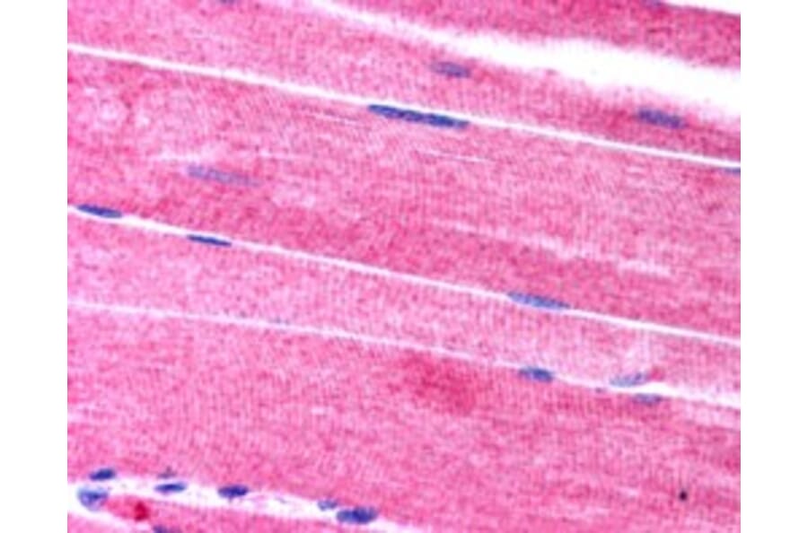 Immunohistochemistry - Anti-SORBS1 Antibody (A83040) - Antibodies.com