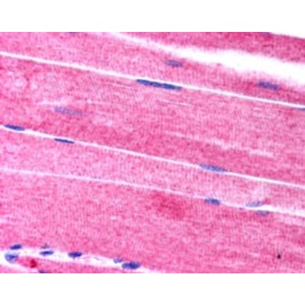 Immunohistochemistry - Anti-SORBS1 Antibody (A83040) - Antibodies.com