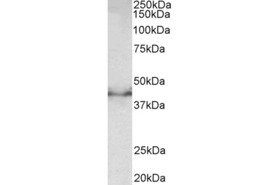 Western Blot - Anti-Doublecortin Antibody (A83041) - Antibodies.com