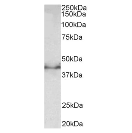 Western Blot - Anti-Doublecortin Antibody (A83041) - Antibodies.com