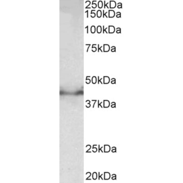 Western Blot - Anti-Doublecortin Antibody (A83041) - Antibodies.com