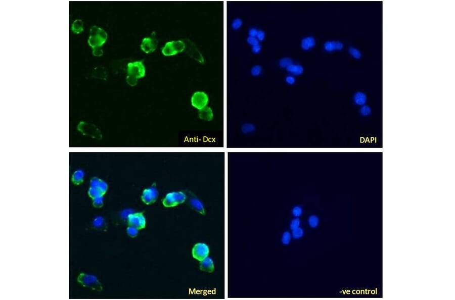 Immunofluorescence - Anti-Doublecortin Antibody (A83041) - Antibodies.com